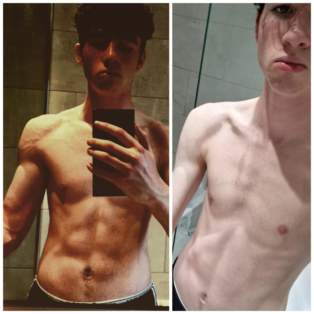 Why Am I Struggling to Gain Weight?